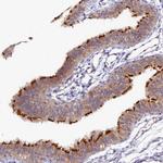 FOPNL Antibody in Immunohistochemistry (IHC)