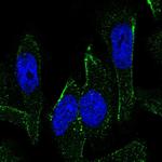 RKHD2 Antibody in Immunocytochemistry (ICC/IF)