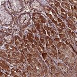 RKHD2 Antibody in Immunohistochemistry (Paraffin) (IHC (P))