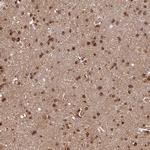 Heme oxygenase 2 Antibody in Immunohistochemistry (Paraffin) (IHC (P))