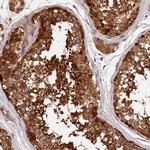 Heme oxygenase 2 Antibody in Immunohistochemistry (Paraffin) (IHC (P))