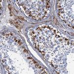 PGM2 Antibody in Immunohistochemistry (Paraffin) (IHC (P))