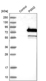 PGM2 Antibody in Western Blot (WB)