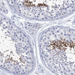 CABYR Antibody in Immunohistochemistry (Paraffin) (IHC (P))