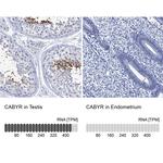 CABYR Antibody in Immunohistochemistry (IHC)