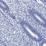 CABYR Antibody in Immunohistochemistry (IHC)