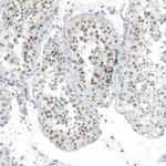 MED20 Antibody in Immunohistochemistry (IHC)