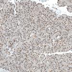 MED20 Antibody in Immunohistochemistry (IHC)