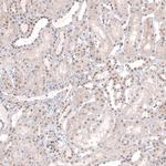 MED20 Antibody in Immunohistochemistry (IHC)