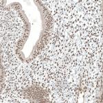 MED20 Antibody in Immunohistochemistry (IHC)