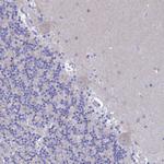 LOC81691 Antibody in Immunohistochemistry (Paraffin) (IHC (P))