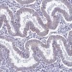 LOC81691 Antibody in Immunohistochemistry (IHC)