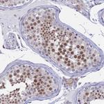 LOC81691 Antibody in Immunohistochemistry (IHC)