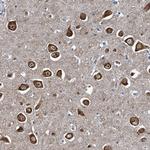 NCKAP1L Antibody in Immunohistochemistry (Paraffin) (IHC (P))