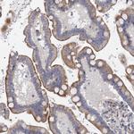 QPCTL Antibody in Immunohistochemistry (Paraffin) (IHC (P))