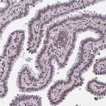 NIPBL Antibody in Immunohistochemistry (Paraffin) (IHC (P))