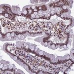 NIPBL Antibody in Immunohistochemistry (Paraffin) (IHC (P))