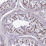 NIPBL Antibody in Immunohistochemistry (Paraffin) (IHC (P))