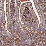 PPP2R3C Antibody in Immunohistochemistry (Paraffin) (IHC (P))