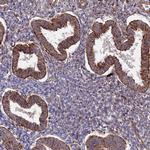 PPP2R3C Antibody in Immunohistochemistry (Paraffin) (IHC (P))