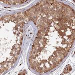 PPP2R3C Antibody in Immunohistochemistry (IHC)