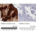 ANKRD2 Antibody in Immunohistochemistry (IHC)