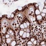 ZC3H18 Antibody in Immunohistochemistry (IHC)