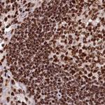 ZC3H18 Antibody in Immunohistochemistry (IHC)