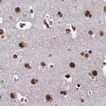 ZC3H18 Antibody in Immunohistochemistry (IHC)