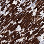 ELAC1 Antibody in Immunohistochemistry (Paraffin) (IHC (P))