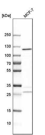 alanyl-tRNA Synthetase Antibody in Western Blot (WB)