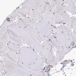 eIF6 Antibody in Immunohistochemistry (Paraffin) (IHC (P))