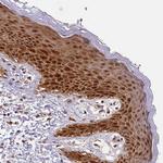 eIF6 Antibody in Immunohistochemistry (Paraffin) (IHC (P))