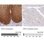 eIF6 Antibody in Immunohistochemistry (IHC)