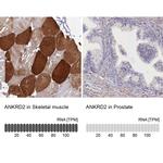 ANKRD2 Antibody in Immunohistochemistry (IHC)