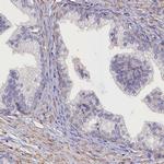 ANKRD2 Antibody in Immunohistochemistry (IHC)