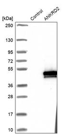 ANKRD2 Antibody in Western Blot (WB)