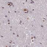 POLR2C Antibody in Immunohistochemistry (IHC)