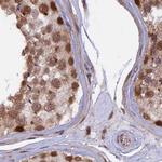 POLR2C Antibody in Immunohistochemistry (IHC)