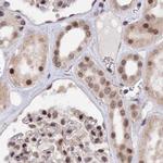 POLR2C Antibody in Immunohistochemistry (IHC)