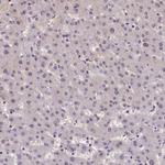 ZC3H4 Antibody in Immunohistochemistry (IHC)