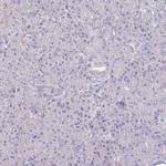 IL18BP Antibody in Immunohistochemistry (Paraffin) (IHC (P))