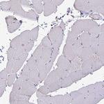 IL18BP Antibody in Immunohistochemistry (Paraffin) (IHC (P))