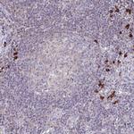 IL18BP Antibody in Immunohistochemistry (IHC)