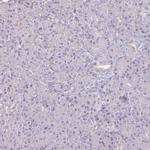 IL18BP Antibody in Immunohistochemistry (IHC)