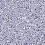 NPM2 Antibody in Immunohistochemistry (Paraffin) (IHC (P))