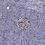 NPM2 Antibody in Immunohistochemistry (Paraffin) (IHC (P))