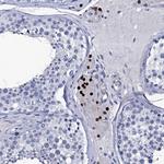 NPM2 Antibody in Immunohistochemistry (Paraffin) (IHC (P))