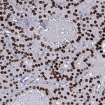 NPM2 Antibody in Immunohistochemistry (IHC)