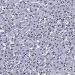 NPM2 Antibody in Immunohistochemistry (IHC)